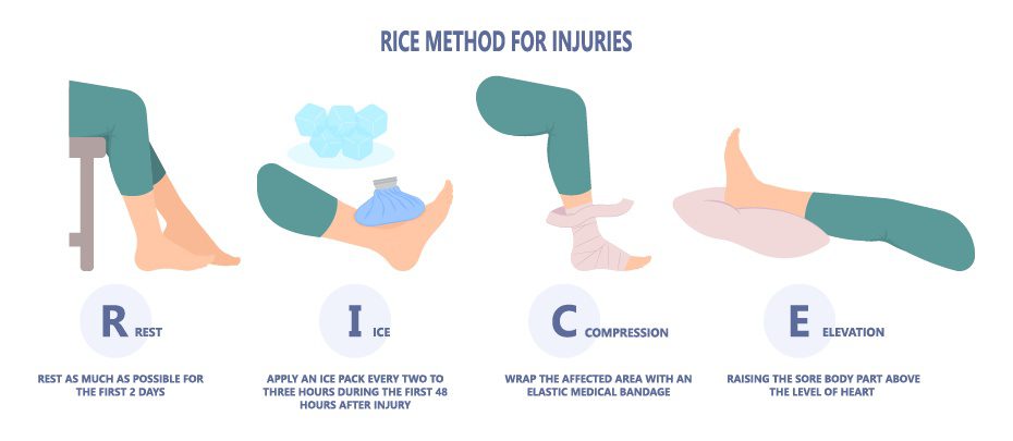 RICE Method